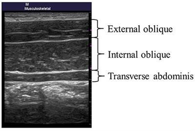 A 100-m Sprint Time Is Associated With Deep Trunk Muscle Thickness in Collegiate Male Sprinters